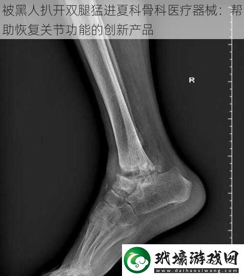 被黑人扒開(kāi)雙腿猛進(jìn)夏科骨科醫(yī)療器械